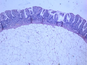 Рис.4а. Морфология образования: Структура представлена жировой тканью (зрелыми адипоцитами) в подслизистом слое, гем-эоз., ув.Х40